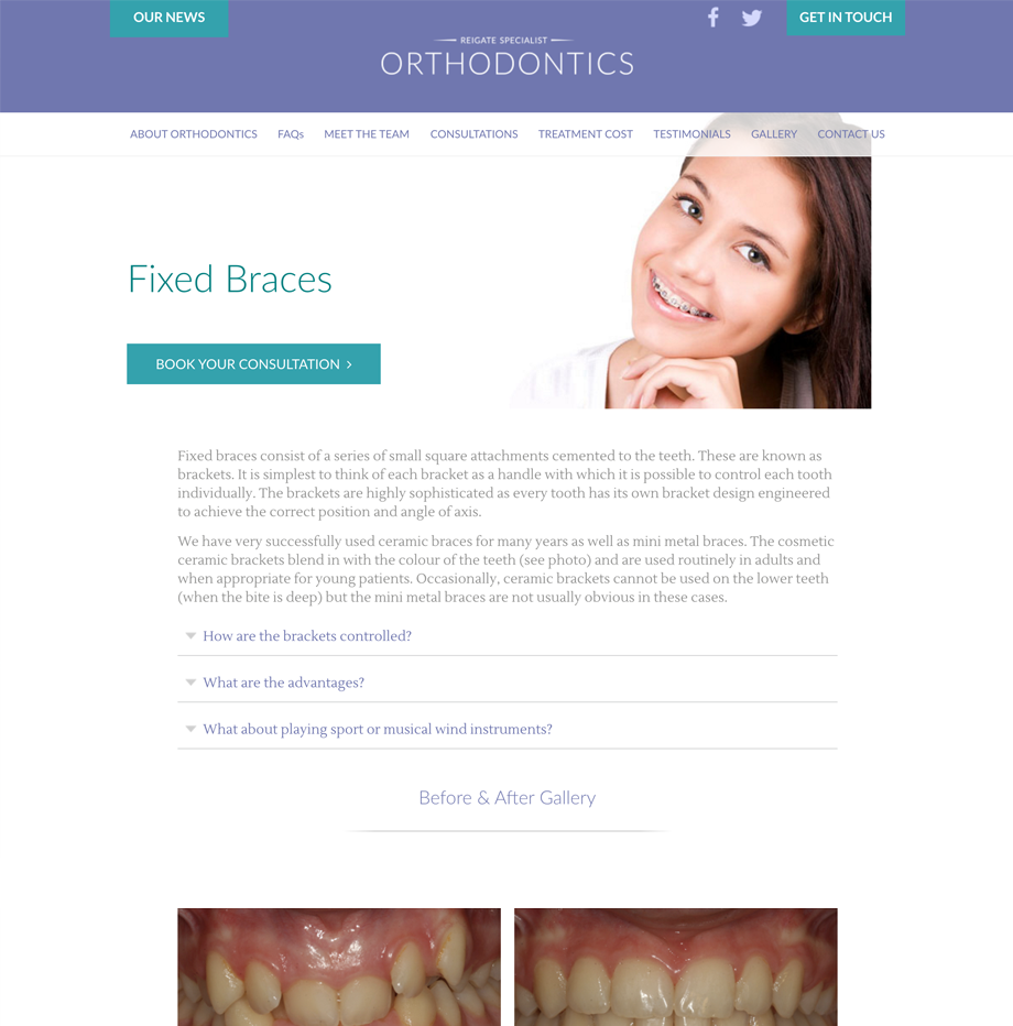 reigate-orthodontics-webpages-1.png